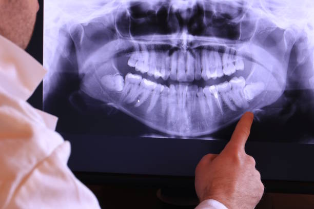 Best Broken or Cracked Tooth Emergency Dentist in Weleetka, OK