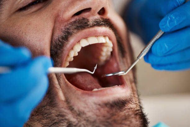 Best Pediatric Emergency Dentist in Weleetka, OK