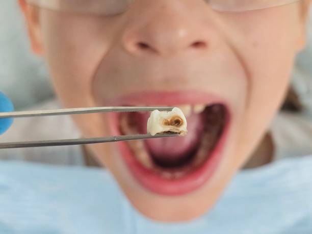 Best Mobile Emergency Dentist in Weleetka, OK